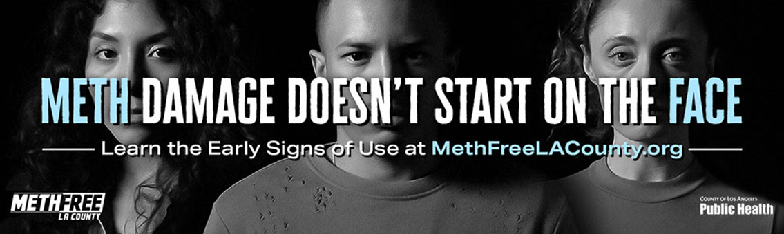 Meth doesn't start on the face